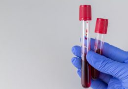 doctor-holding-test-tubes-with-red-blood-ready-testing-space-your-text_224798-645